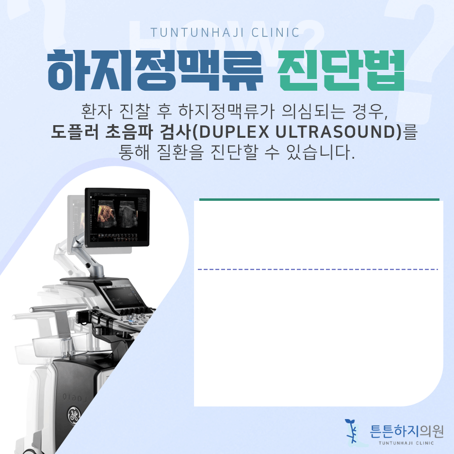 하지정맥류 초음파 검사 이미지