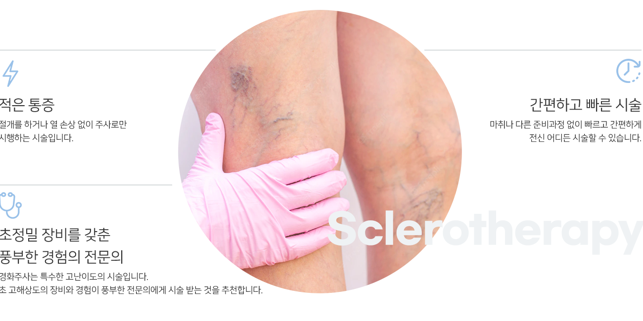 시술특징